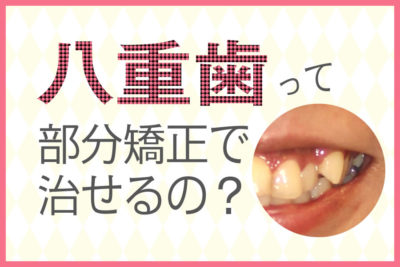 八重歯って部分矯正で治せるの？